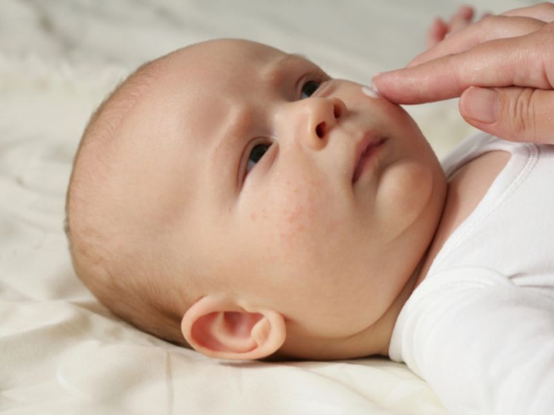 Cách chăm sóc khi trẻ sơ sinh bị sốt phát ban